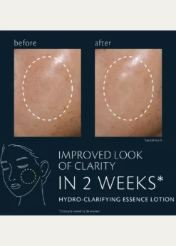 Cle de Peau BeauteHydro-Clarifying Essence Lotion, 5.7 oz.