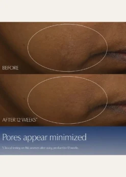 Estee LauderAdvanced Night Repair Synchronized Multi-Recovery Complex Serum with Hyaluronic Acid & Peptides