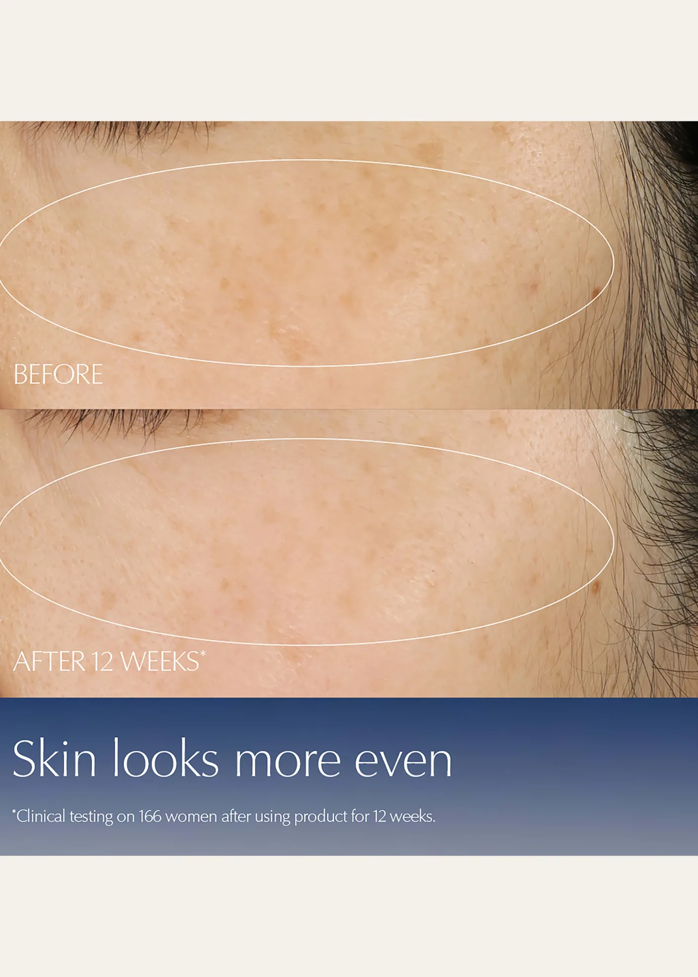 Estee LauderAdvanced Night Repair Synchronized Multi-Recovery Complex Serum with Hyaluronic Acid & Peptides