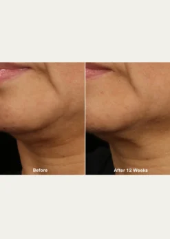 La MerThe Lifting Firming Serum, 1 oz.