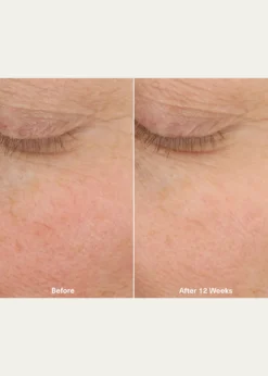 La MerThe Micro Peel Treatment, 1 oz.