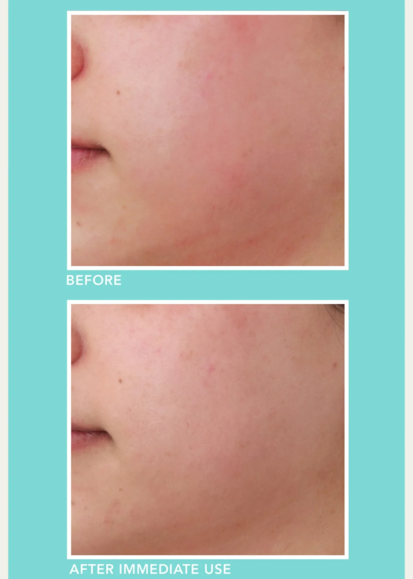 LancerSoothe and Hydrate Serum, 1 oz.