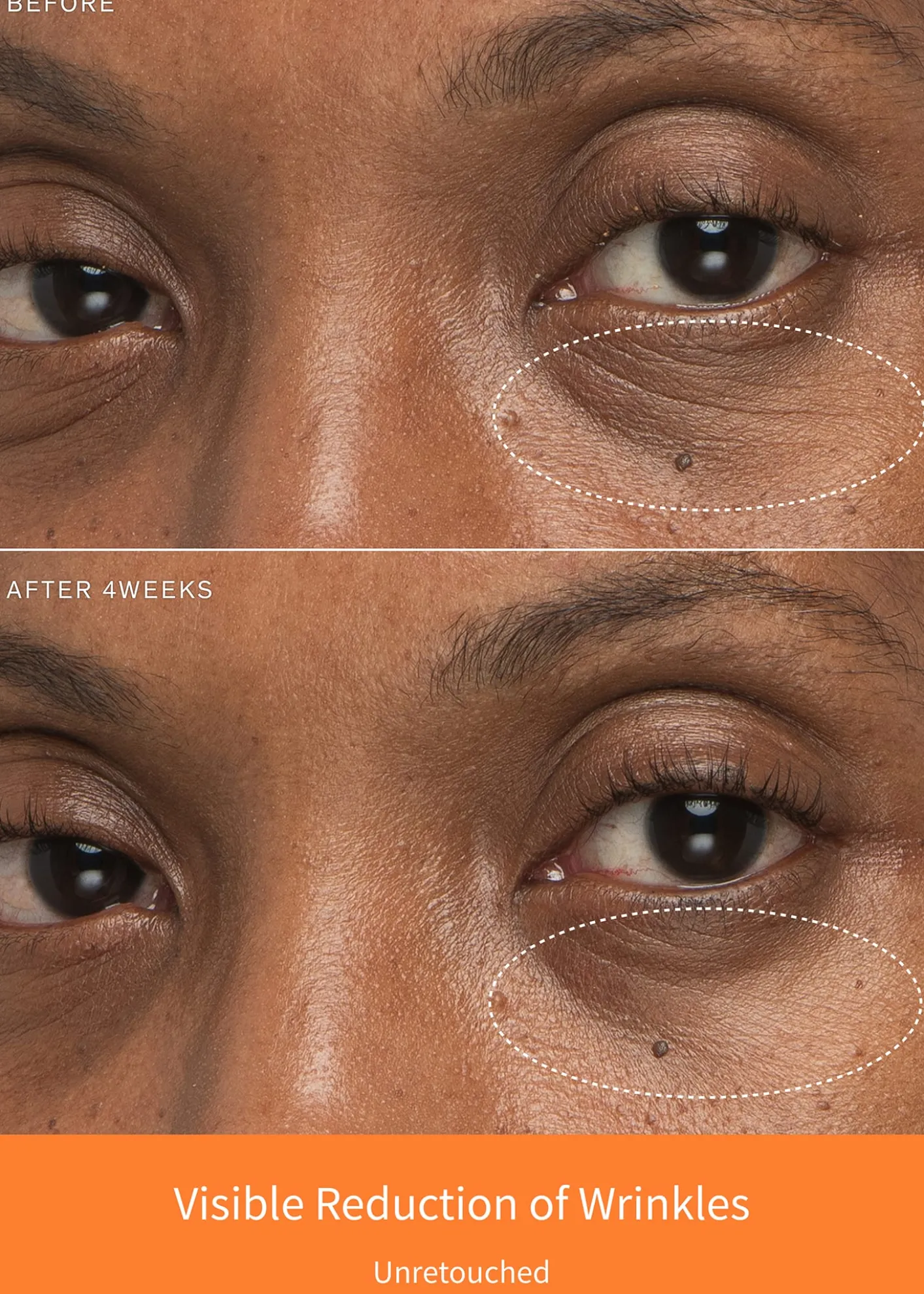 SulwhasooFirst Care Activating Serum VI, 2.02 oz.