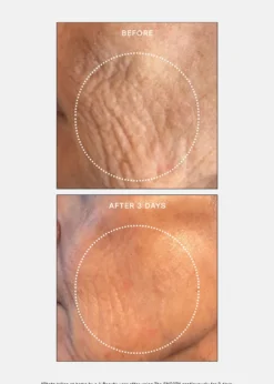 U BeautyThe SMOOTH Dynamic Wrinkle Defense Serum, 1 oz.